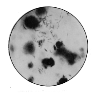 Bacillus of Leprosy