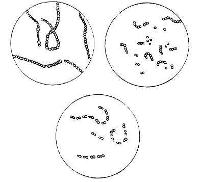 Types of Streptococcus