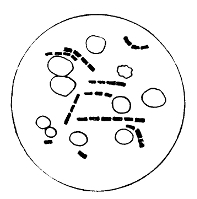 Bacillus of Anthrax and
Blood Corpuscles