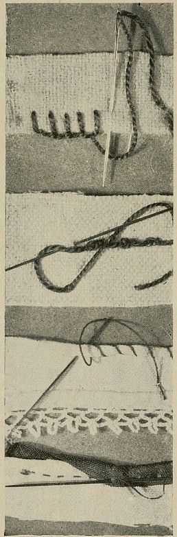 photo of stitches