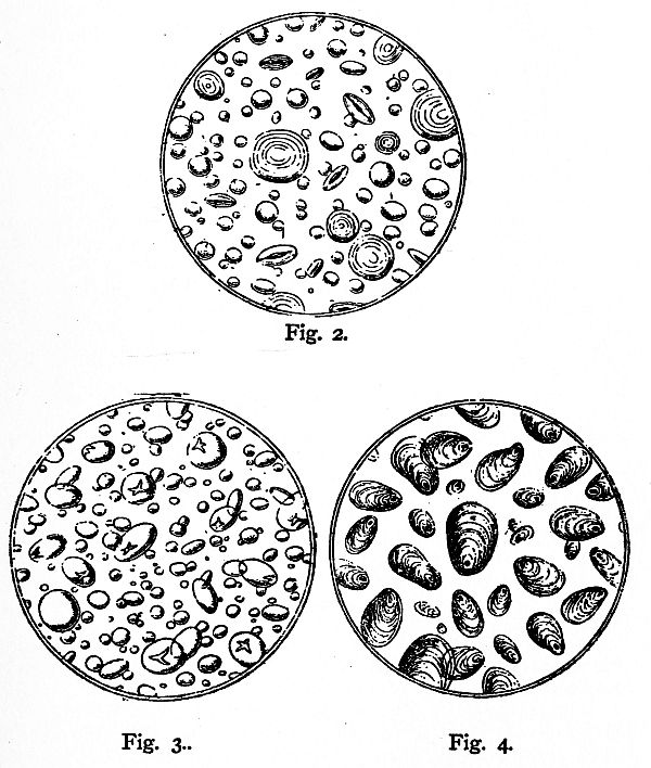 Figures 2, 3, and 4 of fermenting yeast