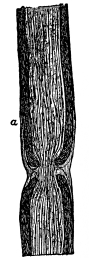 Fig. 5.—Longitudinal Section of a Nerve Fiber with
Stained Fibrils.

a, Medullated sheath.