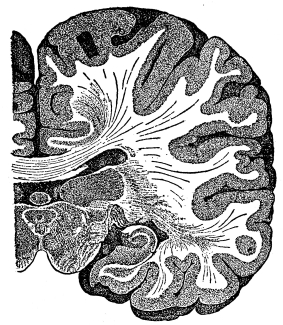Fig. 10.—Frontal Section of the Right Cerebral
Hemisphere.