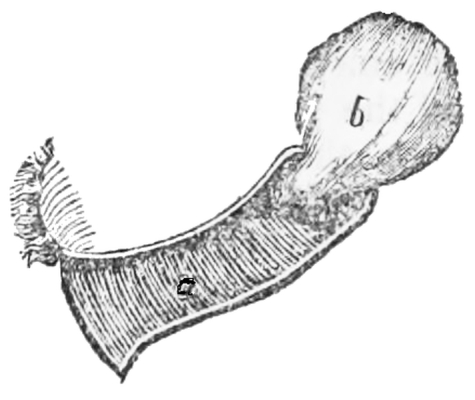 Natural position of the uterus