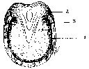 DIAGRAM ILLUSTRATING THE POSITION OF THE GROOVES MADE IN THE HOOF IN COLONEL SMITH'S OPERATION FOR SIDE-BONES.