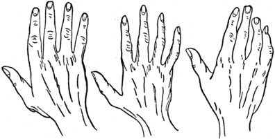 Plate II.— Part II. Fig. 1.—THE CONIC OR ARTISTIC HAND. Fig. 2.—THE PSYCHIC OR IDEALISTIC HAND. Fig. 3.—THE MIXED HAND.