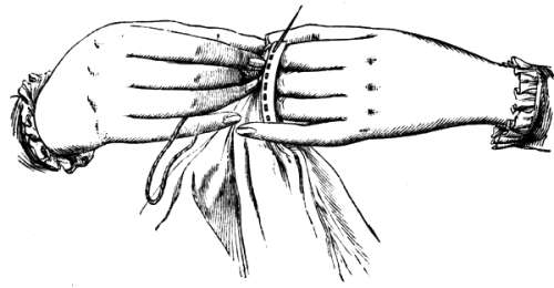 FIG. 3. POSITION OF THE HANDS WITHOUT CUSHION.