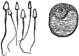 Spermatozoa and Ovum