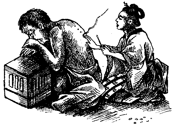 Cauterizing With Moxa.