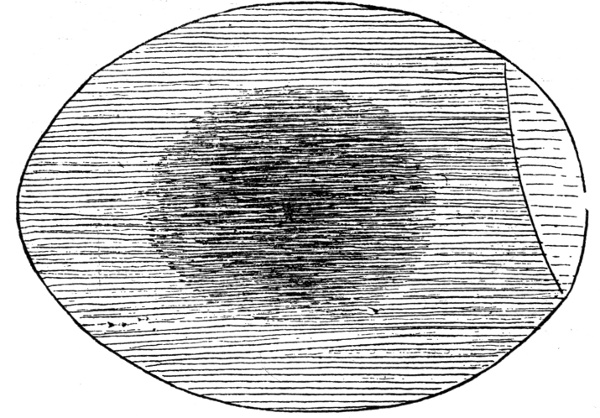 Figure 5.—Egg at End of 120 Hours.