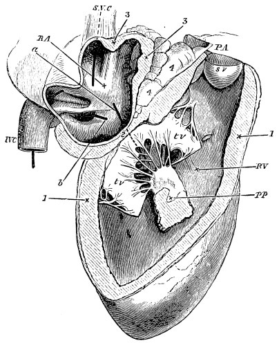 Image unavailable: Fig. 8.—Right Side of the Heart of a Sheep.  R.A. cavity of right auricle; S.V.C. superior vena cava; I.V.C. inferior vena cava; (a piece of whalebone has been passed through each of these;) a, a piece of whalebone passed from the auricle to the ventricle through the auriculo-ventricular orifice; b, a piece of whalebone passed into the coronary vein.  R.V. cavity of right ventricle; tv, tv, two flaps of the tricuspid valve: the third is dimly seen behind them, the a, piece of whalebone, passing between the three. Between the two flaps, and attached to them by chordæ tendineæ, is seen a papillary muscle, PP, cut away from its attachment to that portion of the wall of the ventricle which has been removed. Above, the ventricle terminates somewhat like a funnel in the pulmonary artery, P.A. One of the pockets of the semilunar valve, sv, is seen in its entirety, another partially.  1, the wall of the ventricle cut across; 2, the position of the auriculo-ventricular ring; 3, the wall of the auricle; 4, masses of fat lodged between the auricle and pulmonary artery.