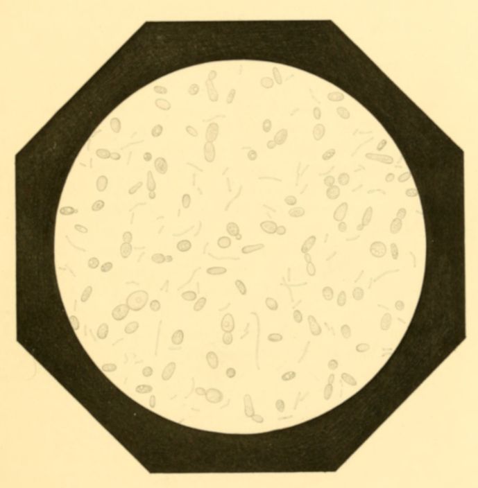 Plate 2. Appearance under the Microscope of the Deposit from “Turned” Beer.