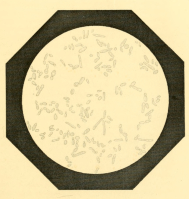 Plate 11. Saccharomyces Pastorianus, in course of Regular Growth.