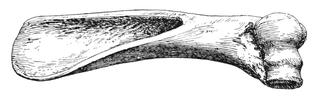 Fig. 34. Bone scraper