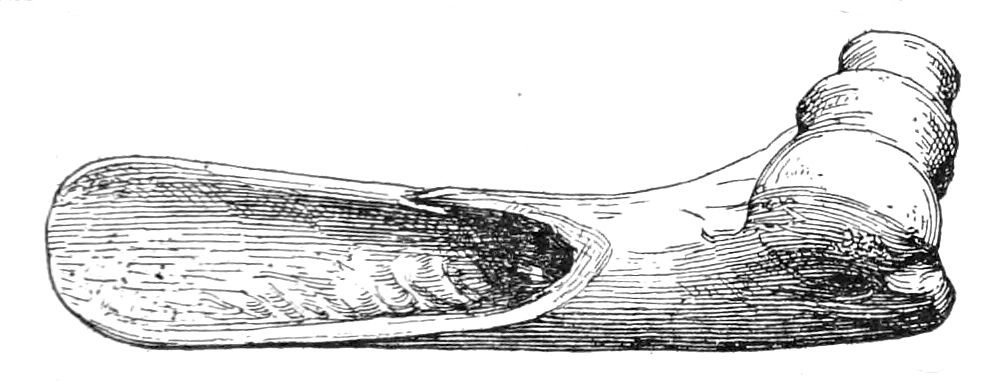 Fig. 35. Bone scraper
