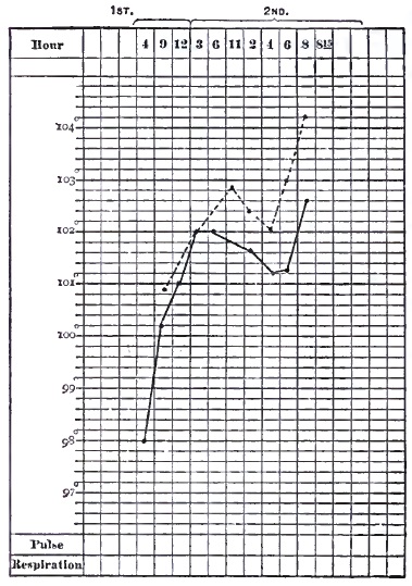 Temperature chart of meningeal hemorrhage
