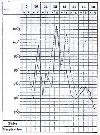 Temperature chart of hemiplegia