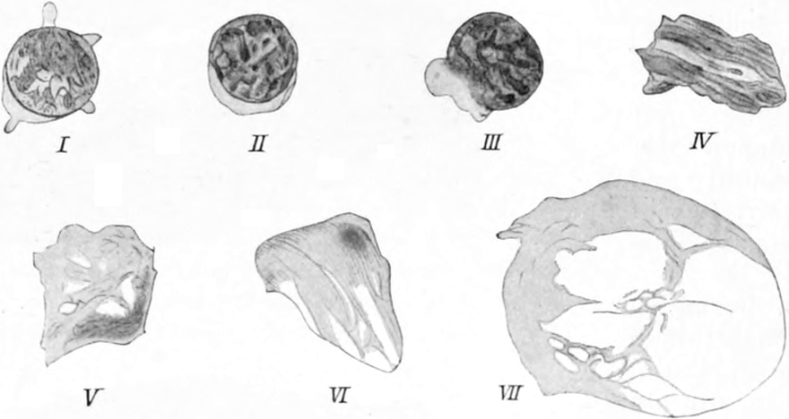 Absterben der Leukocyten bei   Leukämie