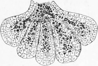 Fettmetamorphose bei der Milchbildung