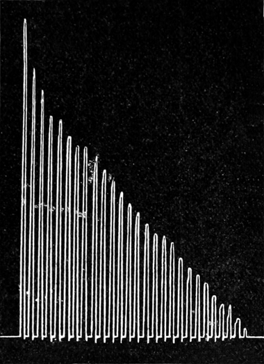 Ermüdung der Fingermuskeln