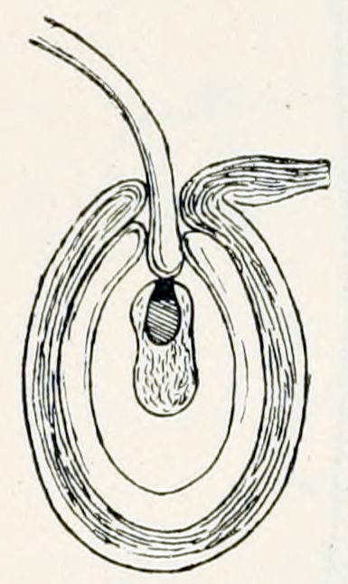A microscopic image of a cross- section. It shows a round, hollow shape with thick walls and an opening at the top. In the centre is a peanut-shaped object, with a black spot at the side directed to the opening. A tube enters through the opening and contacts the peanut-shape at the black spot.