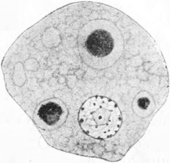 Entamoeba africana