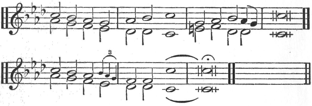 (Music)