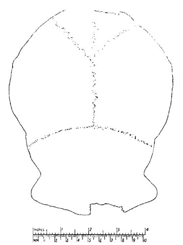 Drawing of skull