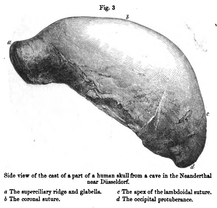 Figure 3. Cast of Human Skull 