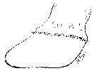 DIAGRAM ILLUSTRATING THE ABNORMAL GROWTH OF HORN AT THE TOE AND HEELS OF THE FOOT WITH CHRONIC LAMINITIS.