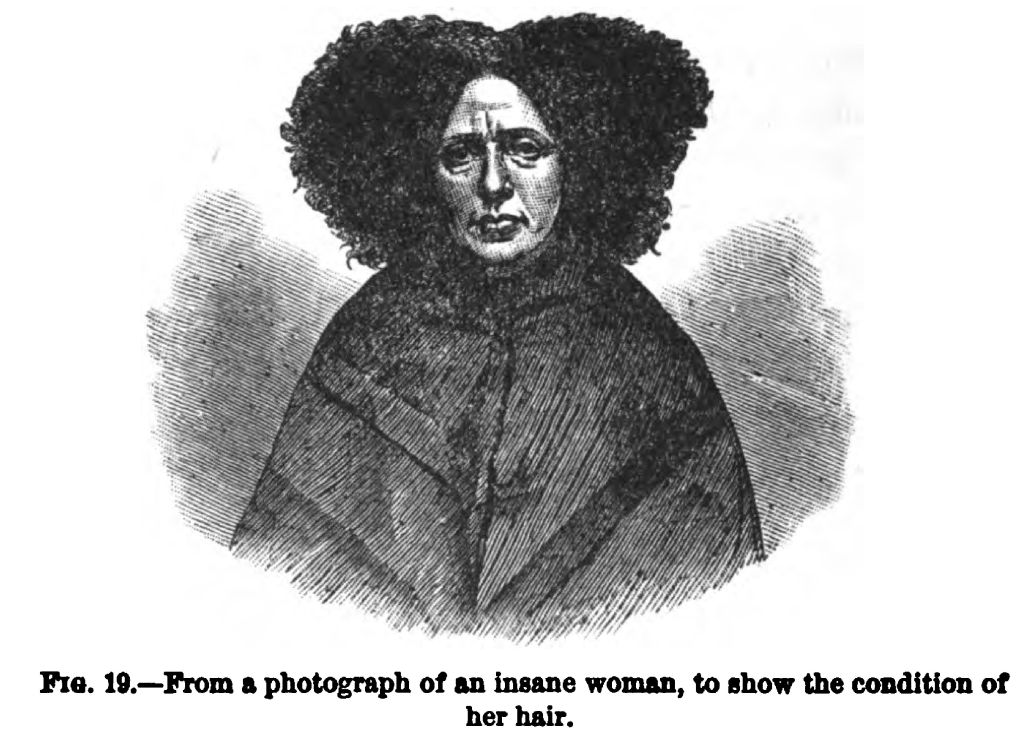 Photograph of an Insane Woman. Fig. 19 