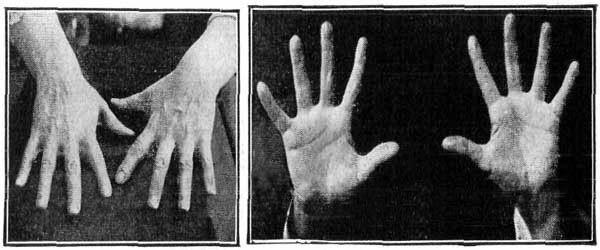 Hands of Mrs. Flora E. Durand