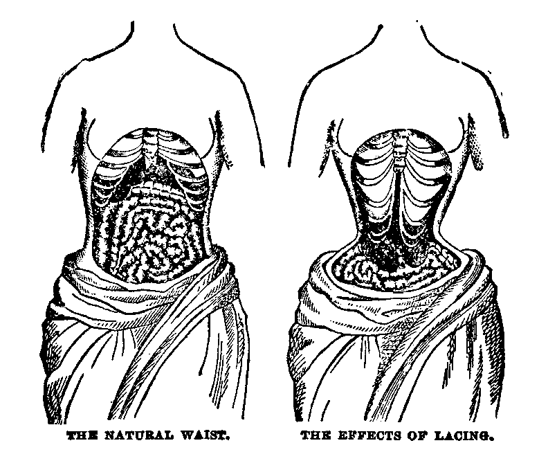 THE NATURAL WAIST versus THE EFFECTS OF LACING.