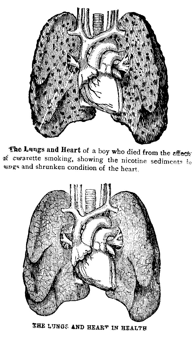 Two Line Drawings of Lungs and Heart