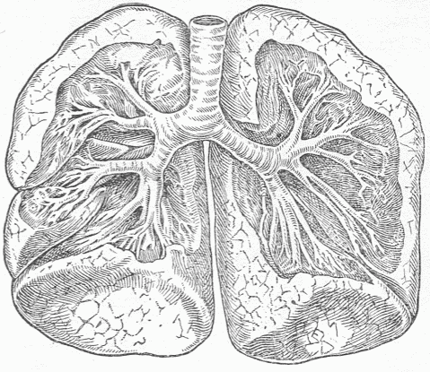 Fig. 10.—The Lungs And Windpipe. Parts of the lungs have been removed to show the branching of the air tubes or bronchi which pass into them. All the tubes and the surfaces of the lungs communicate with the inner surface of the body through the larynx.