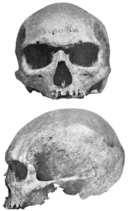 Skull A.