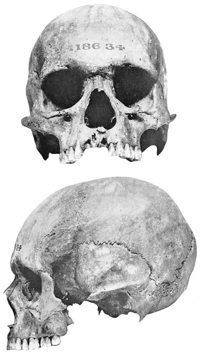 Skull C.
