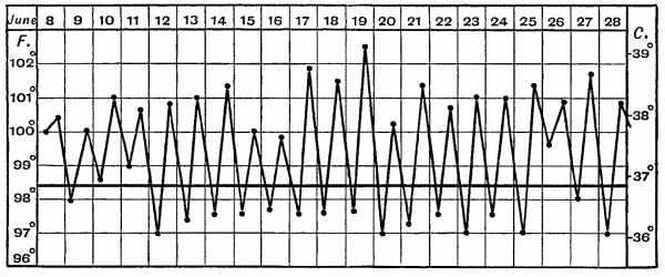 Fig. 11.—Chart of Hectic Fever.