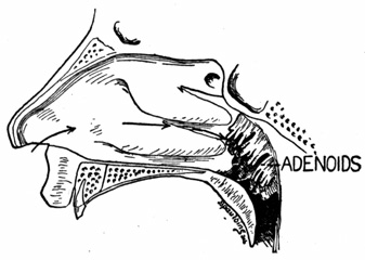 A diagram of the nose and the back of the throat.