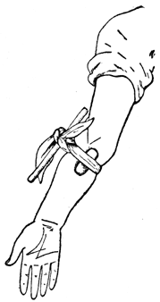 A drawing of an arm with a bandage on it.