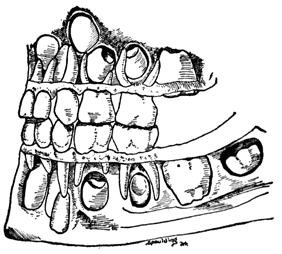 A cut-away view of the mouth, showing teeth and their roots.