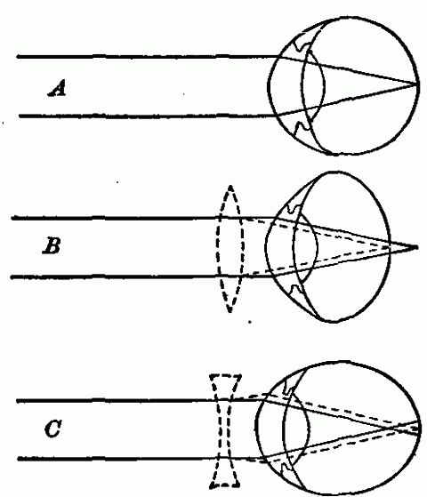 Fig. 164