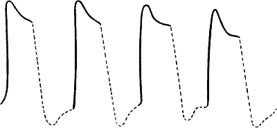 Fig. 105.—After-oscillation