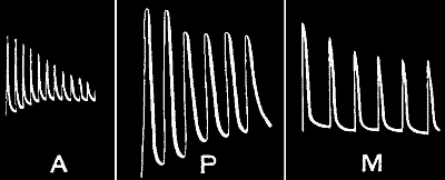 Fig. 113.—Fatigue (A) in Muscle, (P) in Plant, (M) in Metal
