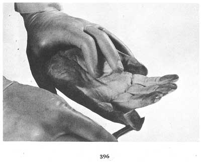 Fig. 396