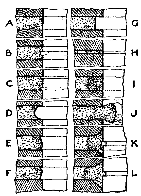 Fig. 3.--Forms of Joints.