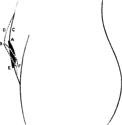 drawing of abdomen