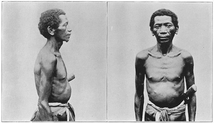 Old man of Zambales (pure Negrito).