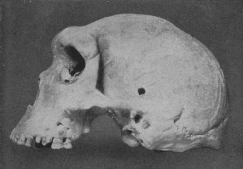SIDE-VIEW OF A PREHISTORIC HUMAN SKULL DISCOVERED IN 1921 IN BROKEN HILL CAVE, NORTHERN RHODESIA