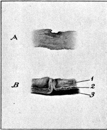 Fig. 25 (a).